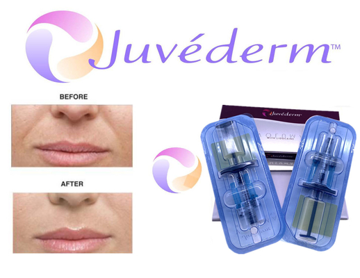 l'incrocio 2x1ml ha collegato il riempitore cutaneo di Juvederm per il materiale da otturazione della grinza del fronte