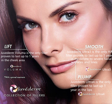 l'incrocio 2x1ml ha collegato il riempitore cutaneo di Juvederm per il materiale da otturazione della grinza del fronte