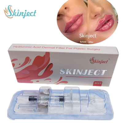 Riempitori cutanei acidi ialuronici profondi delle labbra 2ml di Skinject iniettabili