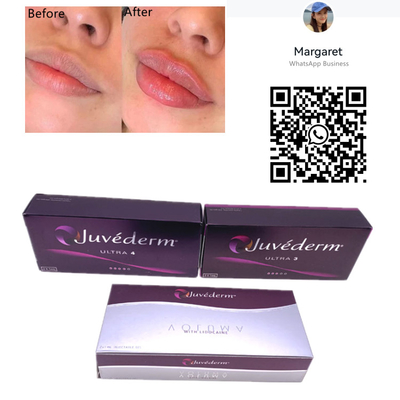 L'incrocio cutaneo degli aghi della siringa del riempitore 2x1ml di Juvederm ha collegato l'iniezione del labbro del gel