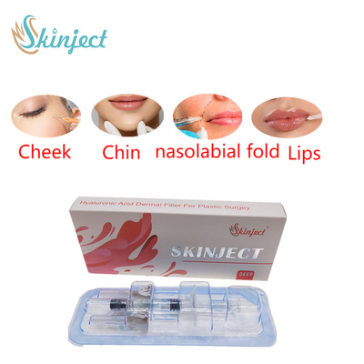 Riempitori cutanei acidi ialuronici profondi delle labbra 2ml di Skinject iniettabili