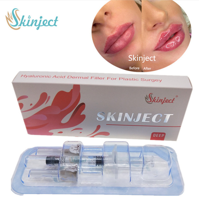 Guancia cutanea profonda iniettabile Chin Nasolabial Fold dei riempitori delle labbra 2ml di Skinject ha