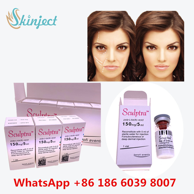 Iniezione dell'Poli-l-lattico-acido PLLA di  per il sollevamento del fronte incavato