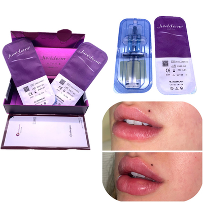 Il potenziamento del labbro di Juvederm 2x1ml del riempitore dell'ha dell'iniezione rimuove le grinze