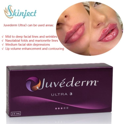 Iniettabile cutaneo acido ialuronico dei riempitori del labbro di cura 2x1ml Juvederm del fronte