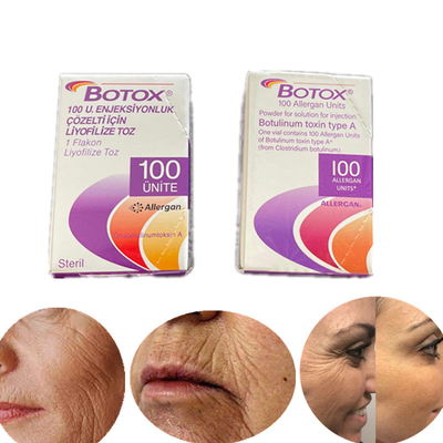 Tipo dell'edizione inglese una tossina botulinica 100 Iu Allergan  per le grinze