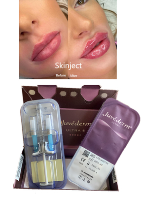 Le labbra rimodellano il riempitore cutaneo acido ialuronico di Juvederm con il lido Ultra4 2X1ml