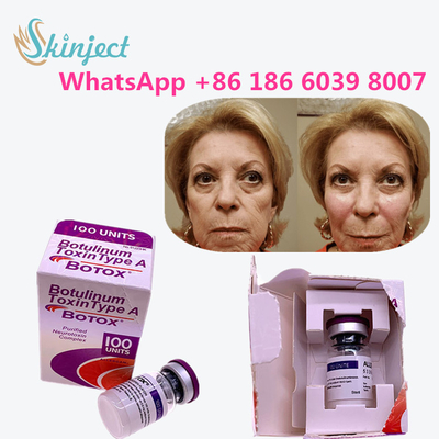 i prodotti antinvecchiamento della tossina botulinica allergan scrivono ad una tossina l'anti grinza a macchina
