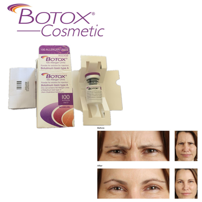 Allergan  iniettabile per le grinze 100ui della fronte