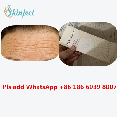 Riempitore cutaneo iniettabile Revolax 24 mg/ml iniezione acida ialuronica dell'ha