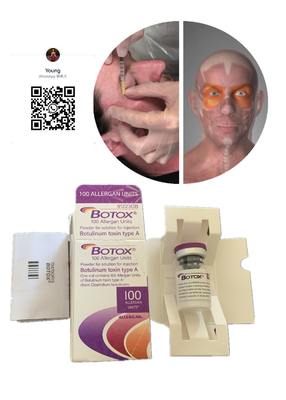 Anti-età botulinica di Juviderm di rimozione della grinza degli anti della grinza riempitori cutanei di Innotoxs s Allergan s anti