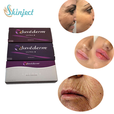 Un incrocio da 2 ml Juvederm ha collegato il riempitore acido ialuronico ultra 3 ultra 4 Voluma