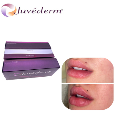 Juvederm Acido Ialuronico Ingrandimento delle labbra Riempitore Dermico Risorgimento del naso Riempitore duraturo per il viso