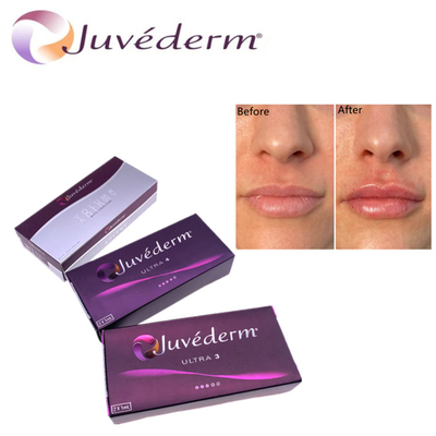Acido iloronico per il riempimento cutaneo Premium Juvederm HA Facial Filler Ultra3 Ultra4 Voluma Per il ringiovanimento del viso