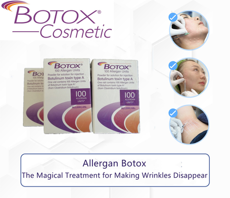 I  di  Allergan di elevata purezza per la grinza della fronte spolverizzano un tipo A di 100 unità