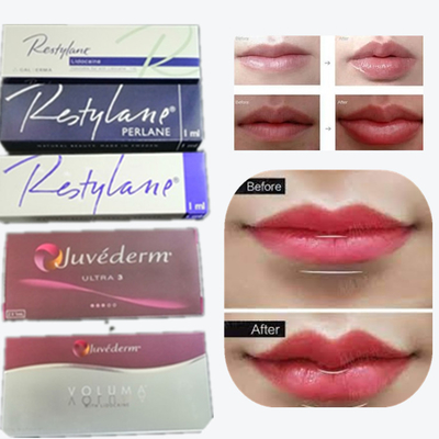 Juvaderm Acido Ialuronico Pen Filler Profondo Volume Iniezioni Facciali Fine
