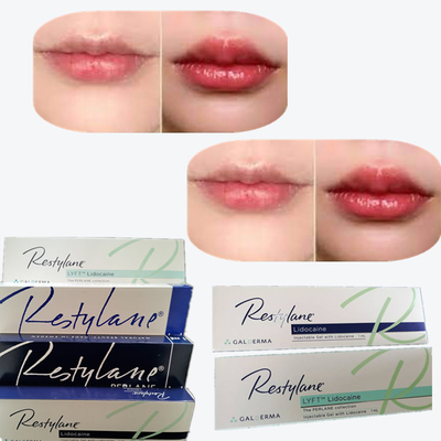 2*1 ml/ scatola Riempitore cutaneo a collegamento croce per l' ingrandimento delle labbra