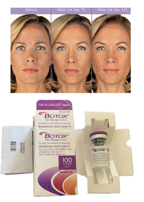 Allergan Botulax  Botulinum Toxin 100IU Anti Rughe Riempitore Dermico