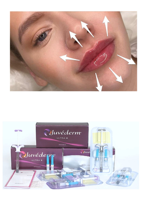 Juvederm' Acido Ialuronico Iniezione Dermica Ultra3 Ultra4 Voluma Per Riempimento delle Labbra