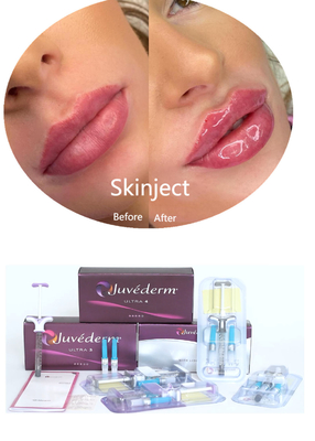 Juvederm Acido Ialuronico Riempitore Dermico Faciale Iniettabile 2*1 ml Imballaggio