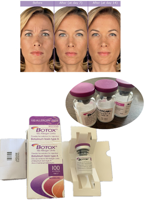 Anti rughe  Botulinum Toxin Allergan 100IU 150iu ' Na