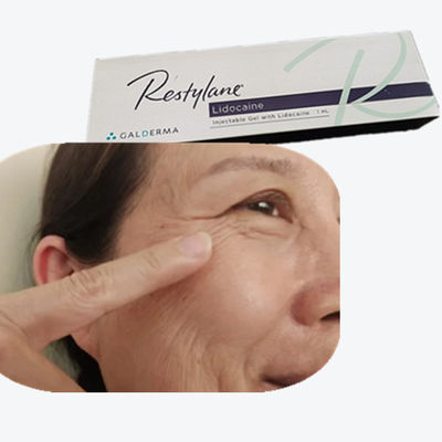 Soluzione di ialuronidasi, riempitore cutaneo a collegamento crociato HA Iniezione per linee nasali