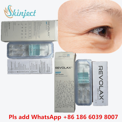 Acido ialuronico iniettabile 1 ml Derm Lines Chirurgia plastica