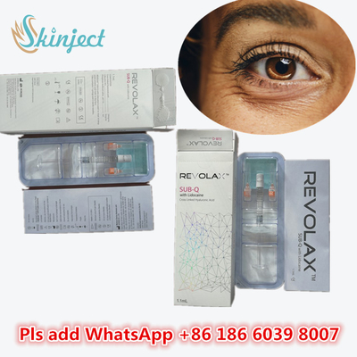 Gel medico di ialuronato di sodio Acido ialuronico Dermal Revolax Depth Filler 1 ml Per iniezione sulle labbra