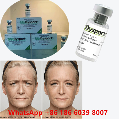 Tossina botulinica 100 unità BTX Iniezione Tipo A Uso cosmetico