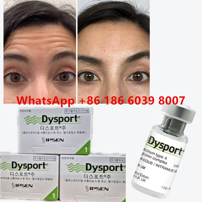 Toxina Botulinica Dysport 100u Clostridium Botulinum Tipo A Per Rimpiccioli Faciali Anti-Aging