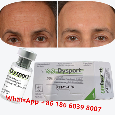 Dysport della tossina botulinica Clostridium botulinum tipo A per le zampe di corvo