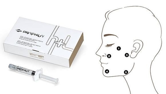 Lungo durata 62mg 2ml Riempitivo Dermico Iniettabile Profhilo H+L Ialuronato di Sodio