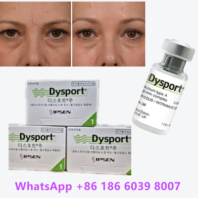 Dysport della tossina botulinica Clostridium botulinum tipo A Per le pieghe nasali