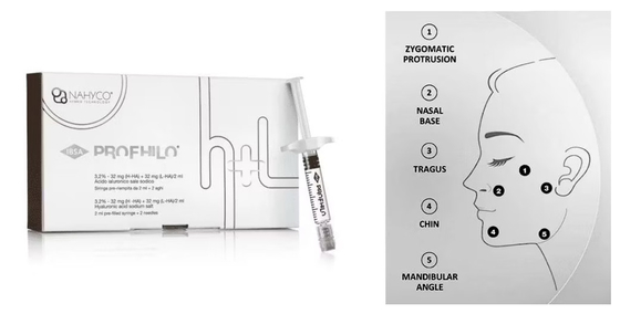 Ago di sollevamento a 5 punti dall'aspetto naturale Filler dermico iniettabile Profhilo