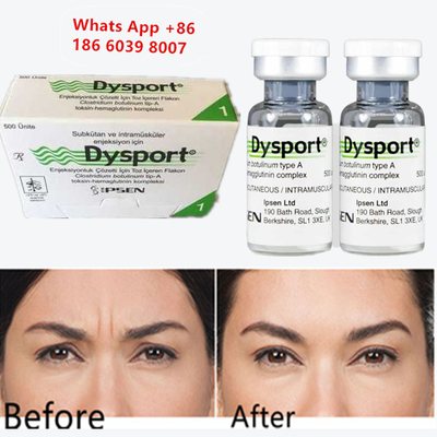 Tossina Botulinica A Dysport Iniettabile Botox per l'Aumento del Mento