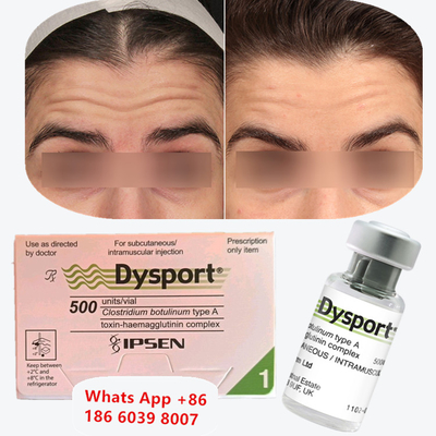 Tossina botulinica A Dysport Iniezione di Botox per le linee dei labbra