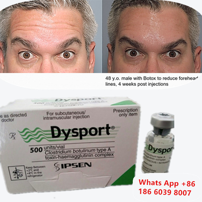 Tossina botulinica A Dysport Iniezione di Botox per le linee dei labbra