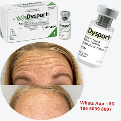 Dysport della tossina botulinica Clostridium botulinum tipo A Per la correzione del naso
