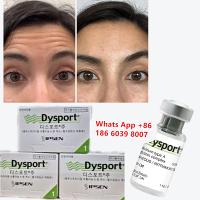 Dysport botulinum toxin tipo A per le linee fruncite e glabeliche