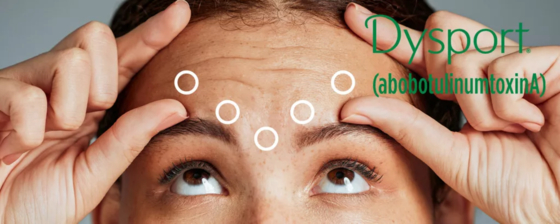 Dysport 500 per iniezione abobotulinumtoxinA Botox 500U