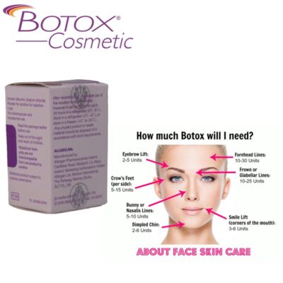Allergan Botox 100IU Tossina Botulinica con durata di conservazione di 3 anni e durata di 4-8 mesi