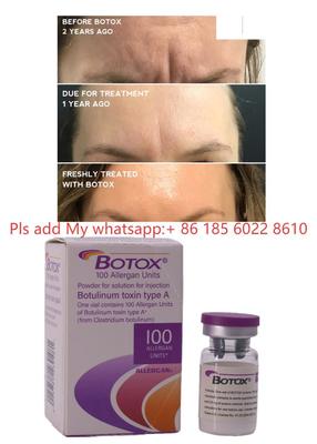 Iniezione di Botox Allergan Botulax Tossina Botulinica Rimuovi le Rughe