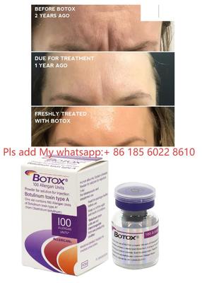 Allergan Botox 100UI Dysport Iniezione Botulax Tossina Botulinica Rimuovi Rughe