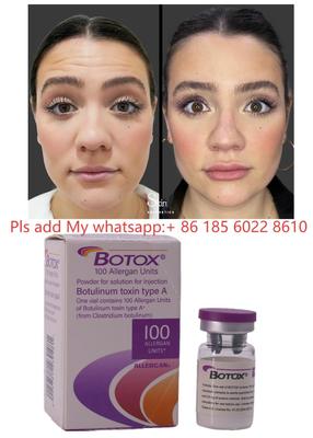 Tossina botulinica Botulax Dysport Allergan Botox per la riduzione delle rughe e cosmetica