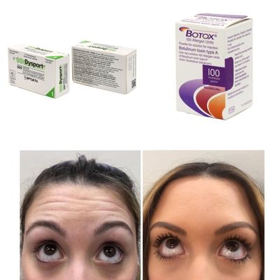 100 Unità Coreane BTX Tossina Botulinica per Rughe e Linee Sottili