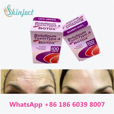Allergan Botox Botulinum Toxin Tipo A 100 unità per la rimozione delle rughe con una durata di 4~6 mesi