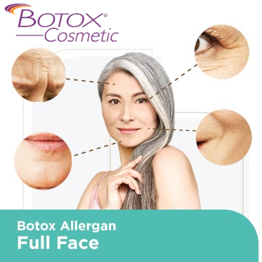Toxin Allergan 100u Tossina botulinica formulazione in polvere che offre benefici per il rilassamento muscolare levigante delle rughe e il rimodellamento del viso