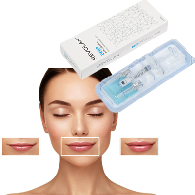 OEM 1.1ml Revolax Fine Deep Sub-Q Lightweight Dermal Filler per linee sottili e ringiovanimento della pelle