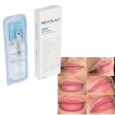 Revolax Acido Ialuronico Riempitore Dermico Naturale Ingrossamento Labiale Augmentazione del Volume Faciale Restauro