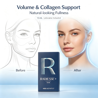 Radiesse Iniezione Collagene Boosting Filler per il viso Correzione immediata per le linee profonde